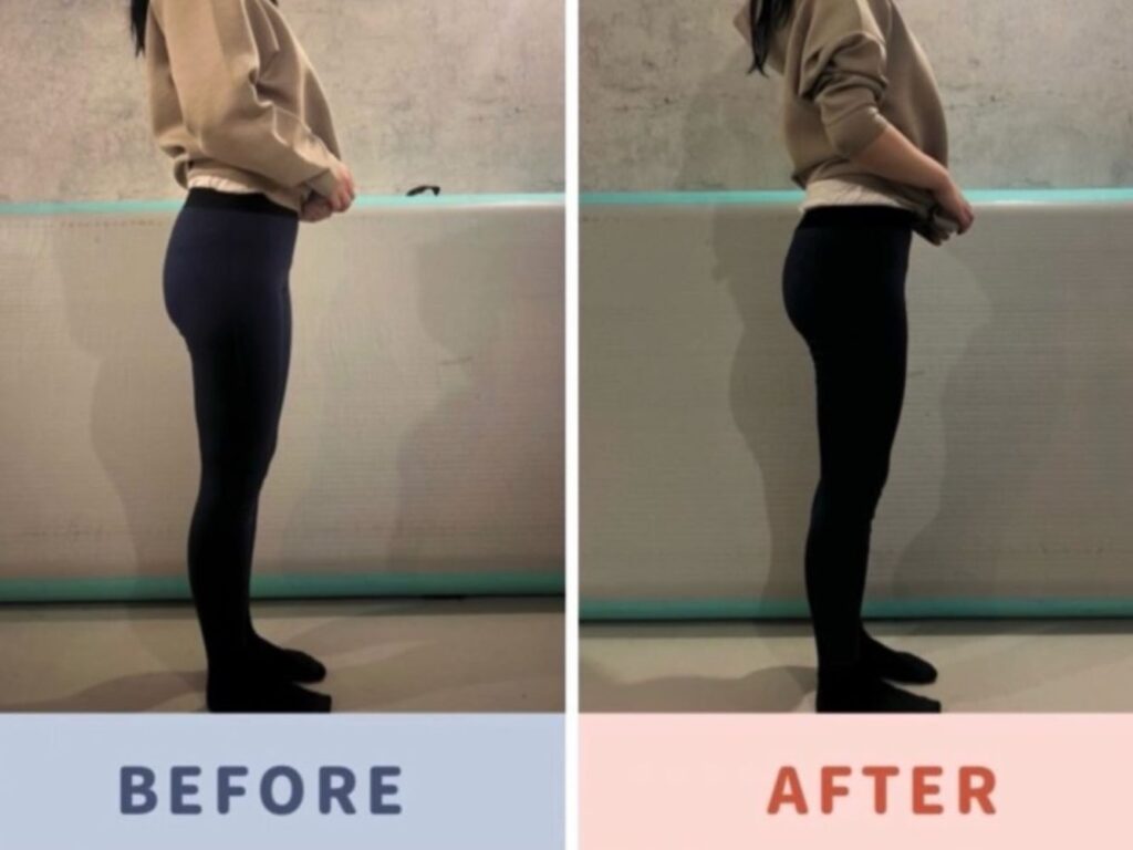 Spolog(スポログ)西新宿 ビフォーアフター