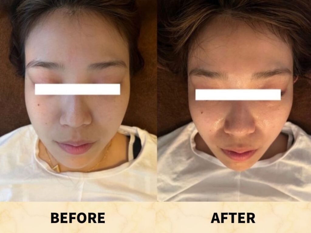 Spolog(スポログ)西新宿 ビフォーアフター